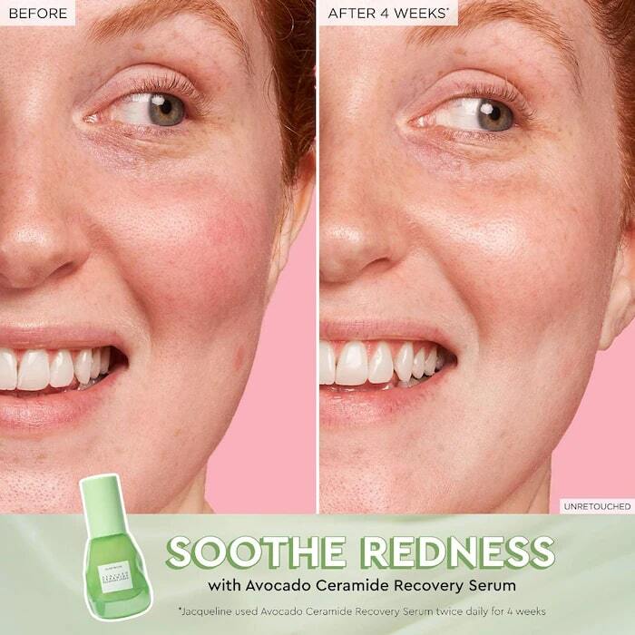 AVOCADO CERAMIDE RECOVERY SERUM