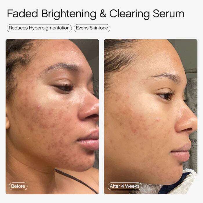 FADED SERUM